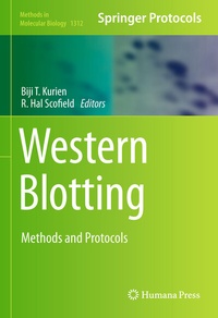 Abbildung von: Western Blotting - Humana