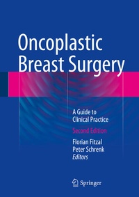 Bild vergrößern Bild: Oncoplastic Breast Surgery - Springer
