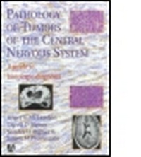 Abbildung von: Pathology of Tumors of the Central Nervous System - Hodder Arnold