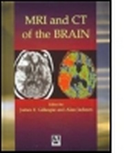 Abbildung von: MRI and CT of the Brain - Hodder Arnold