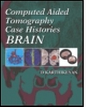 Abbildung von: Computed Aided Tomography Case Histories: Brain - Hodder Arnold