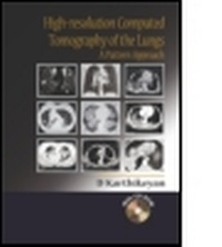 Abbildung von: High-Resolution Computed Tomography of the Lungs: A Pattern Approach - Hodder Arnold
