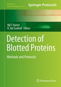 Abbildung von: Detection of Blotted Proteins - Humana
