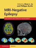 Bild: MRI-Negative Epilepsy - Cambridge University Press