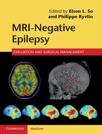 Abbildung von: MRI-Negative Epilepsy - Cambridge University Press