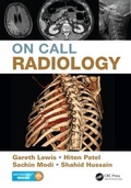 Cover: On Call Radiology - CRC Press