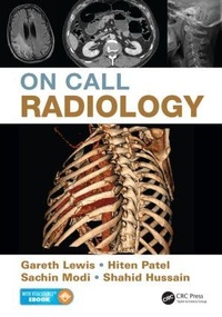 Enlarge image Cover: On Call Radiology - CRC Press