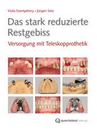 Abbildung von: Das stark reduzierte Restgebiss - Quintessenz Verlag