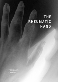 Enlarge image Cover: The Rheumatic Hand - BoD - Books on Demand