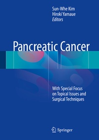 Abbildung von: Pancreatic Cancer - Springer