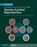 Cover: Atlas of Vitrified Blastocysts in Human Assisted Reproduction - Cambridge University Press