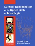 Cover: Surgical Rehabilitation of the Upper Limb in Tetraplegia - Saunders