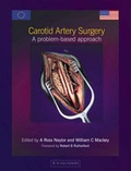 Cover: Carotid Artery Surgery - Saunders