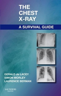 Enlarge image Cover: The Chest X-Ray: A Survival Guide - Saunders