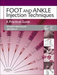 Abbildung von: Foot and Ankle Injection Techniques - Churchill Livingstone