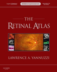 Enlarge image Cover: The Retinal Atlas - Saunders