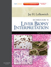 Abbildung von: Scheuer's Liver Biopsy Interpretation - Saunders