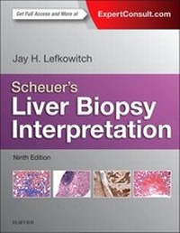 Abbildung von: Scheuer's Liver Biopsy Interpretation - Elsevier