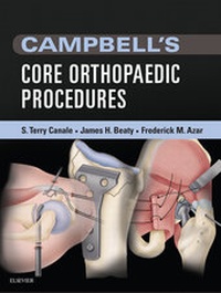 Abbildung von: Campbell's Core Orthopaedic Procedures E-Book - Elsevier