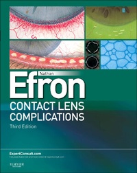 Abbildung von: Contact Lens Complications - Saunders