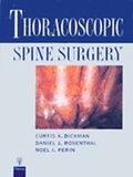 Bild: Thoracoscopic Spine Surgery - Thieme