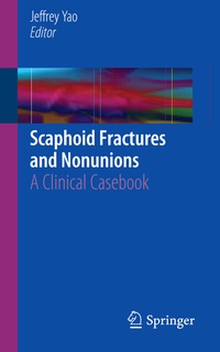 Abbildung von: Scaphoid Fractures and Nonunions - Springer