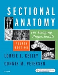 Abbildung von: Sectional Anatomy for Imaging Professionals - Mosby