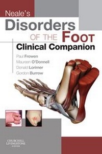 Abbildung von: Neale's Disorders of the Foot Clinical Companion - Elsevier