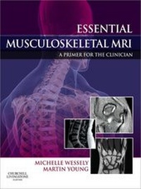 Abbildung von: Essential Musculoskeletal MRI E-Book - Elsevier