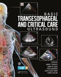 Bild: Basic Transesophageal and Critical Care Ultrasound - CRC Press