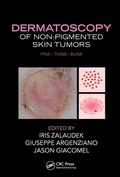 Cover: Dermatoscopy of Non-Pigmented Skin Tumors - CRC Press