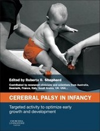Abbildung von: Cerebral Palsy in Infancy - Churchill Livingstone