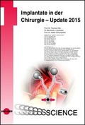 Cover: Implantate in der Chirurgie - Update 2015 - UNI-MED