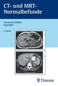 Enlarge image Cover: CT und MRT Normalbefunde - Thieme