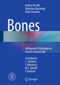 Cover: Bones - Springer