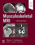 Cover: Musculoskeletal MRI - Elsevier