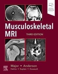 Enlarge image Cover: Musculoskeletal MRI - Elsevier