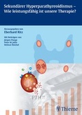 Cover: Sekund&auml;rer Hyperparathyreoidismus - Wie leistungsf&auml;hig ist unsere Therapie ? - Thieme