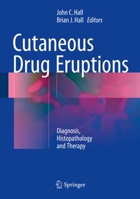Abbildung von: Cutaneous Drug Eruptions - Springer
