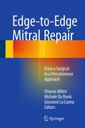 Bild: Edge-to-Edge Mitral Repair - Springer