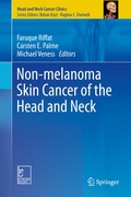 Cover: Non-melanoma Skin Cancer of the Head and Neck - Springer