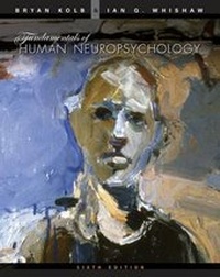 Abbildung von: Fundamentals of Human Neuropsychology - Worth Publishers Inc.,U.S.