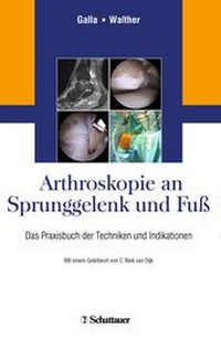 Abbildung von: Arthroskopie an Sprunggelenk und Fuß - Schattauer