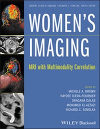 Enlarge image Cover: Women's Imaging - MRI with Multimodality Correlation - Wiley