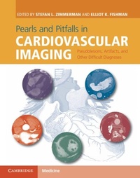 Enlarge image Cover: Pearls and Pitfalls in Cardiovascular Imaging - Cambridge University Press