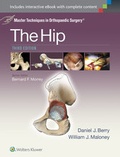 Cover: Master Techniques in Orthopaedic Surgery: The Hip - Lippincott Williams and Wilkins