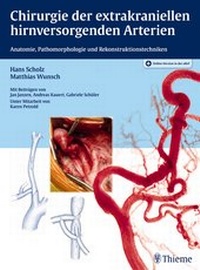 Abbildung von: Chirurgie der extrakraniellen hirnversorgenden Arterien - Thieme