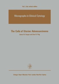 Abbildung von: The Cells of Uterine Adenocarcinoma - S Karger AG