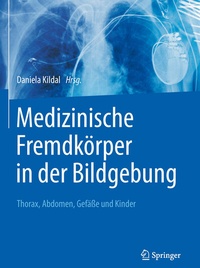 Abbildung von: Medizinische Fremdkörper in der Bildgebung - Springer