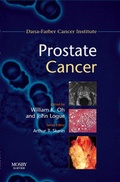 Cover: Prostate Cancer - Mosby